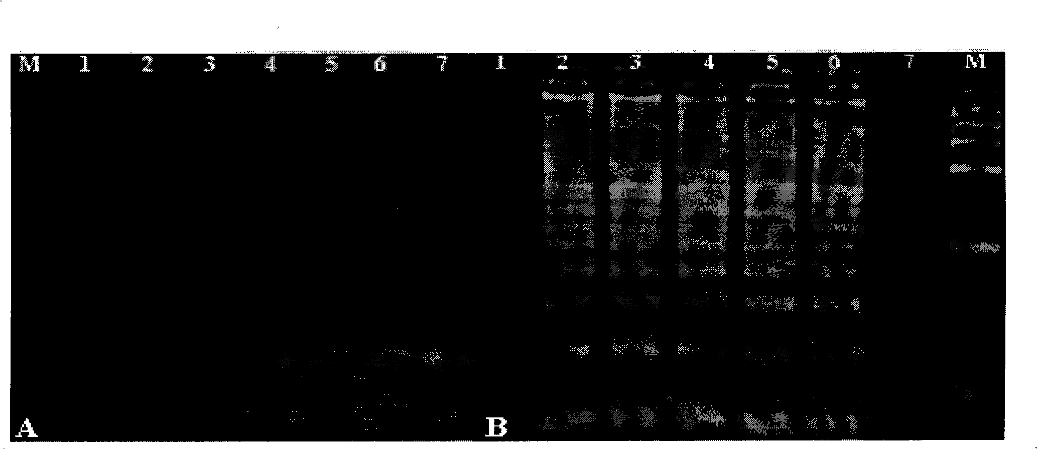 Method for detecting high-pathogenicity blue ear disease