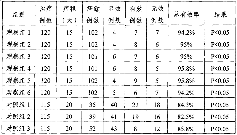 Chinese medicinal composition for treating cyclomastopathy and preparation method thereof