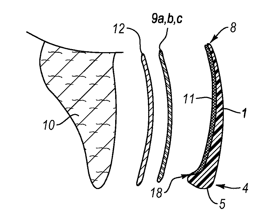 Dental veneers and methods of manufacture