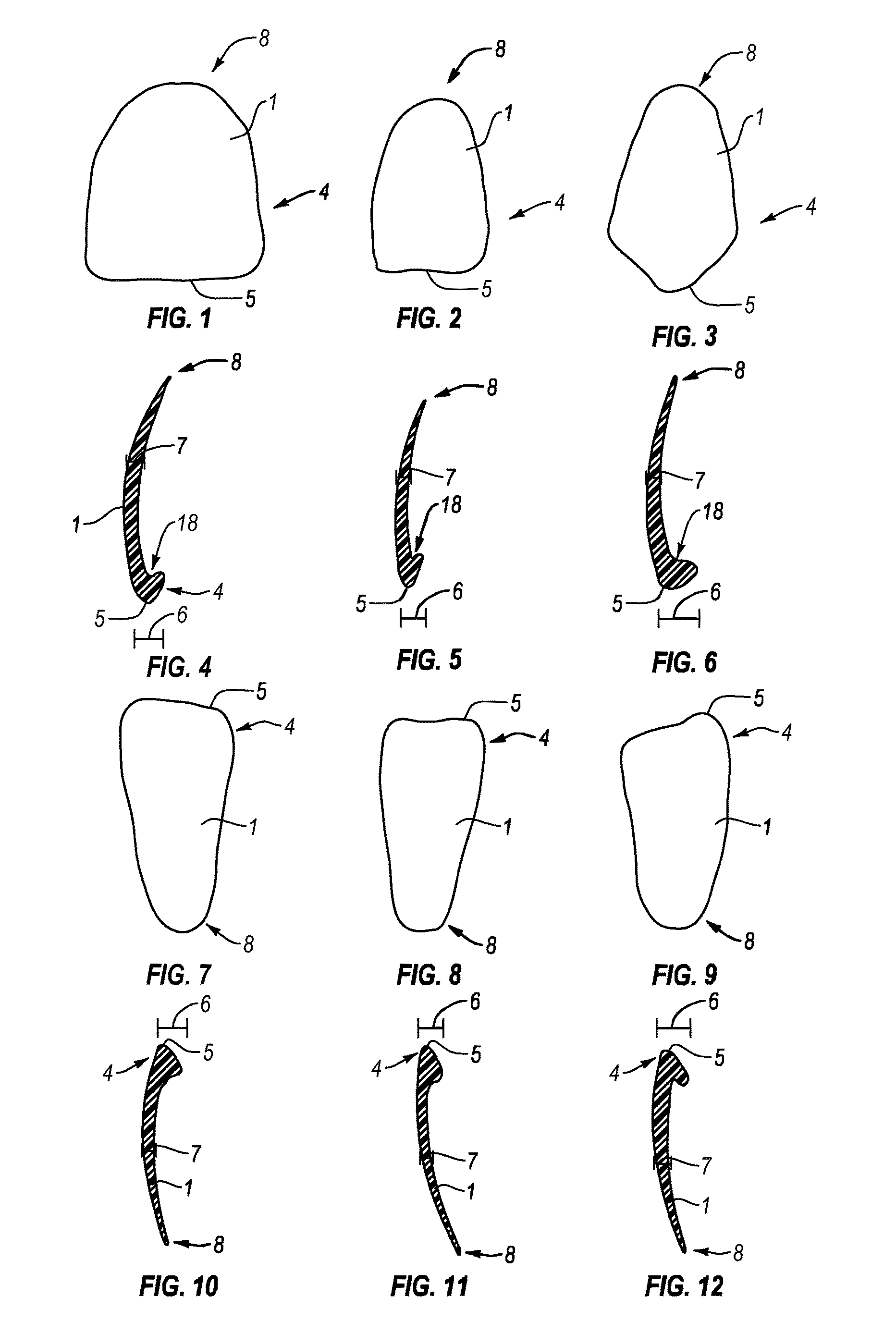 Dental veneers and methods of manufacture