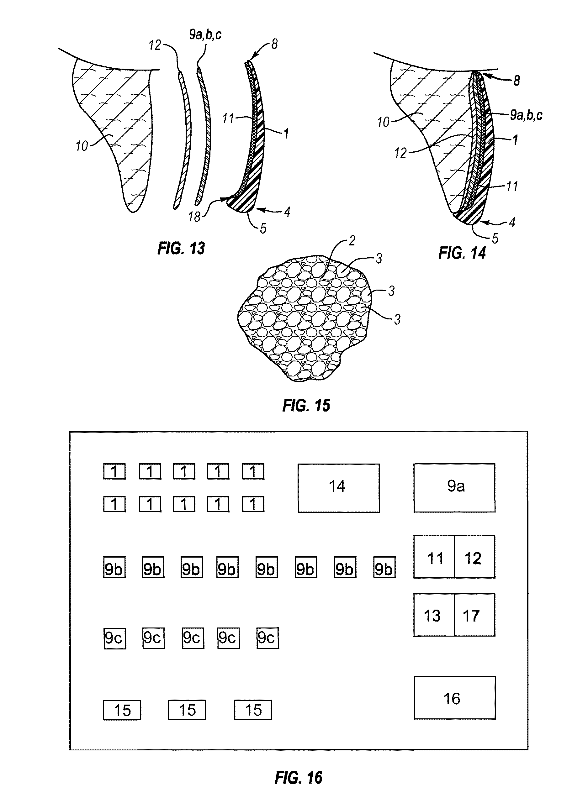 Dental veneers and methods of manufacture