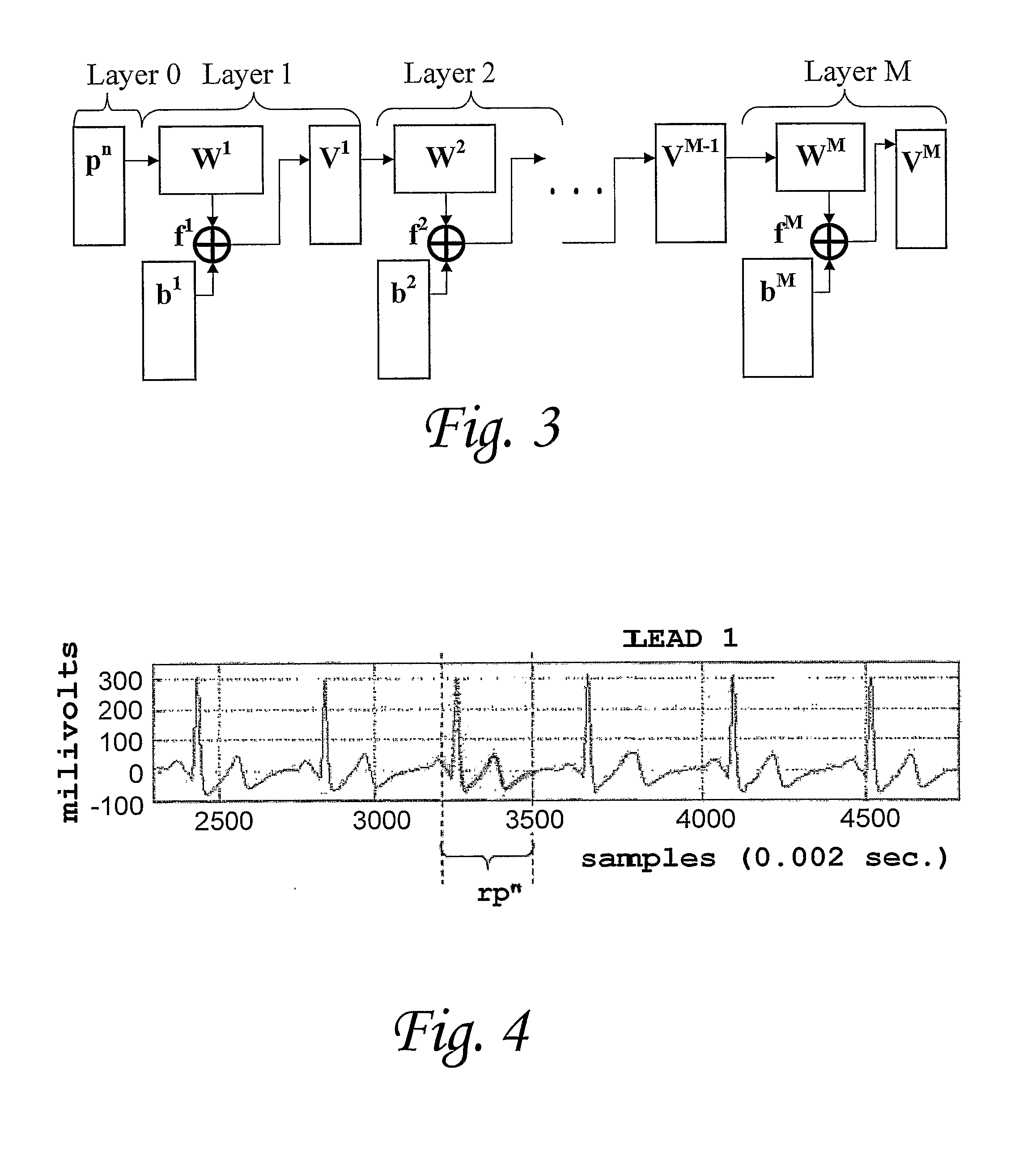 Method and System for Diagnosis of Cardiac Diseases Utilizing Neural Networks