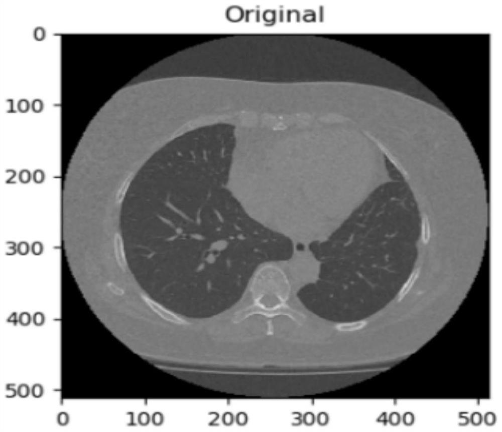 CT image-based lung segmentation method, device and computer-readable storage medium
