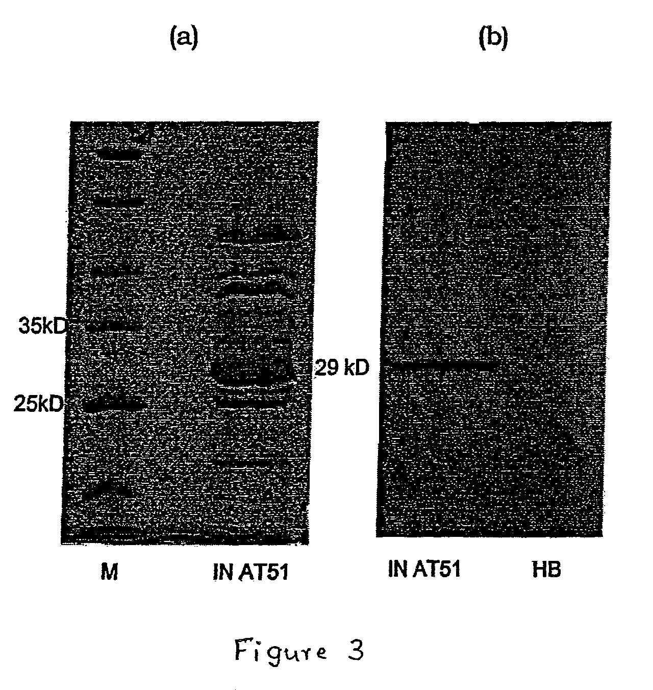 Humanized high affinity recombinant antibody against Hepatitis B surface antigen