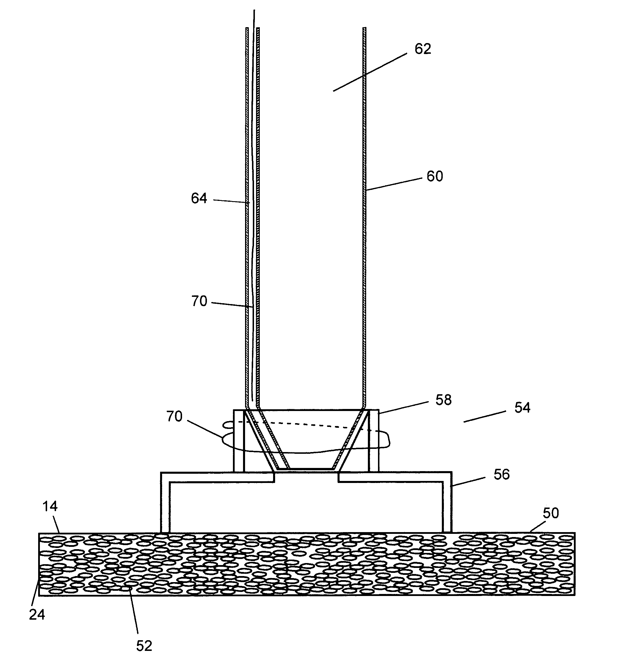 Resorbable polymeric device for localized drug delivery