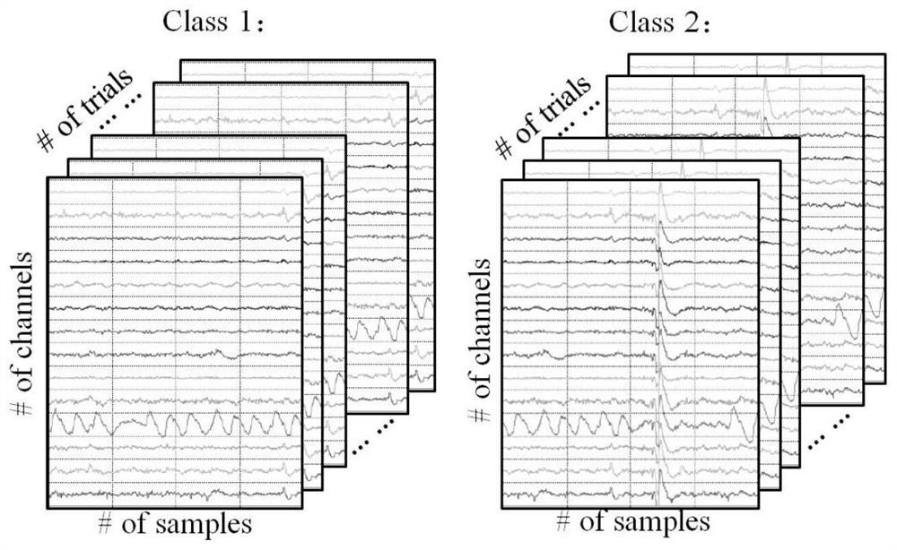 Motor imagery electroencephalogram signal classification method based on hybrid model