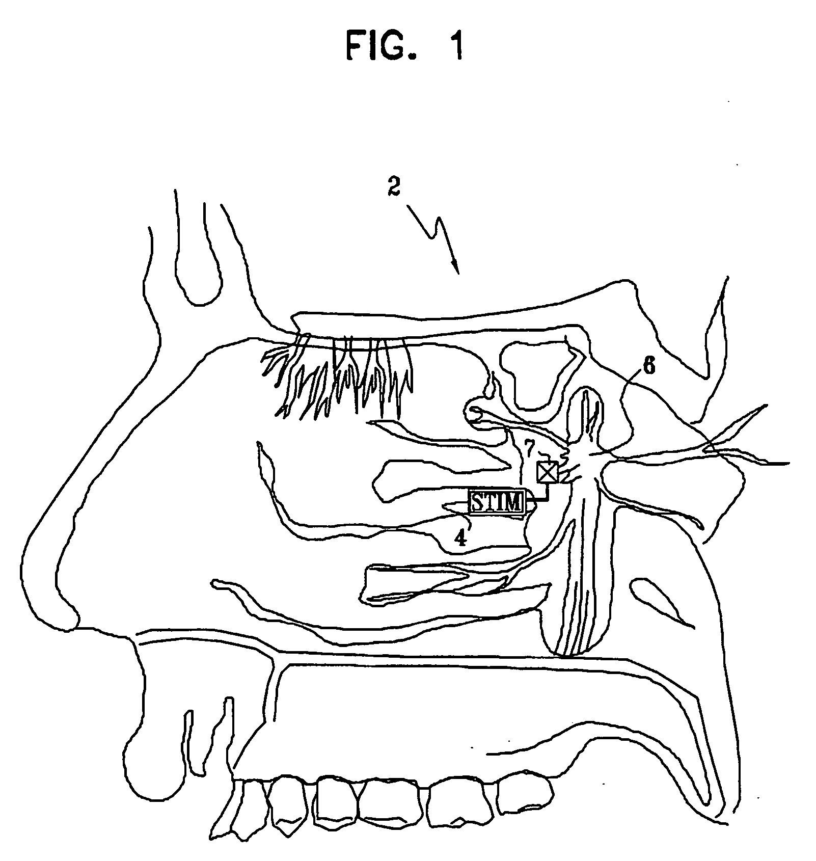 Methods and apparatus for modifying properties of the bbb and cerebral circulation by using the neuroexcitatory and/or neuroinhibitory effects of odorants on nerves in the head
