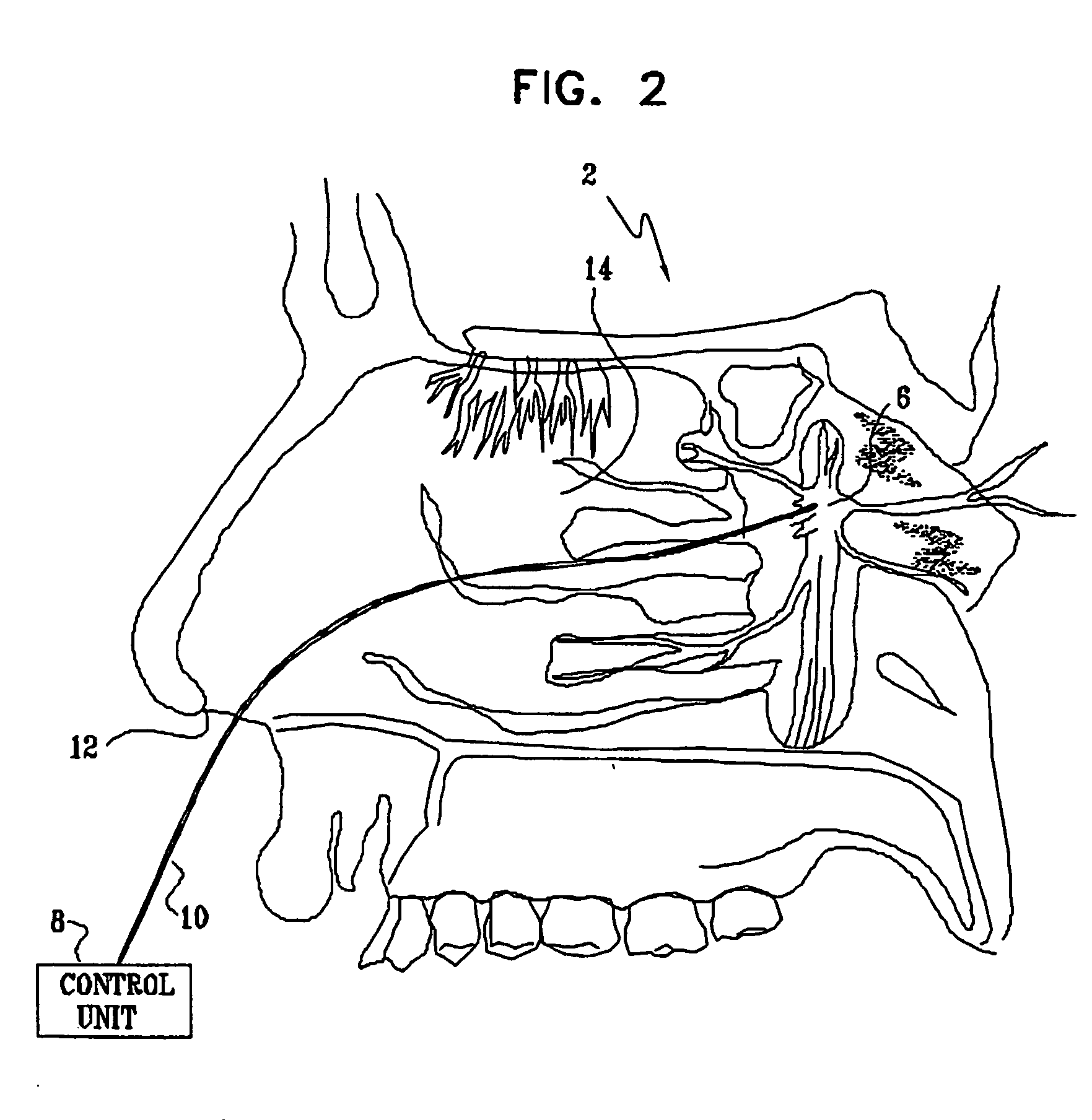 Methods and apparatus for modifying properties of the bbb and cerebral circulation by using the neuroexcitatory and/or neuroinhibitory effects of odorants on nerves in the head