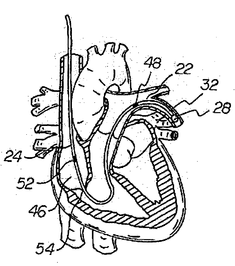 Apparatus and method for measuring myocardial oxygen consumption