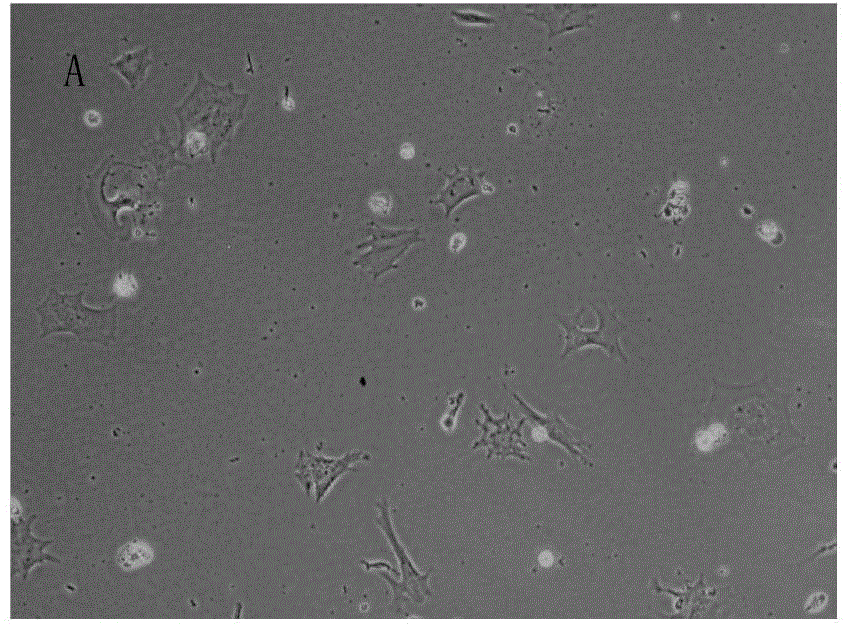 Special culture medium and special culture method for sub-totipotent stem cells