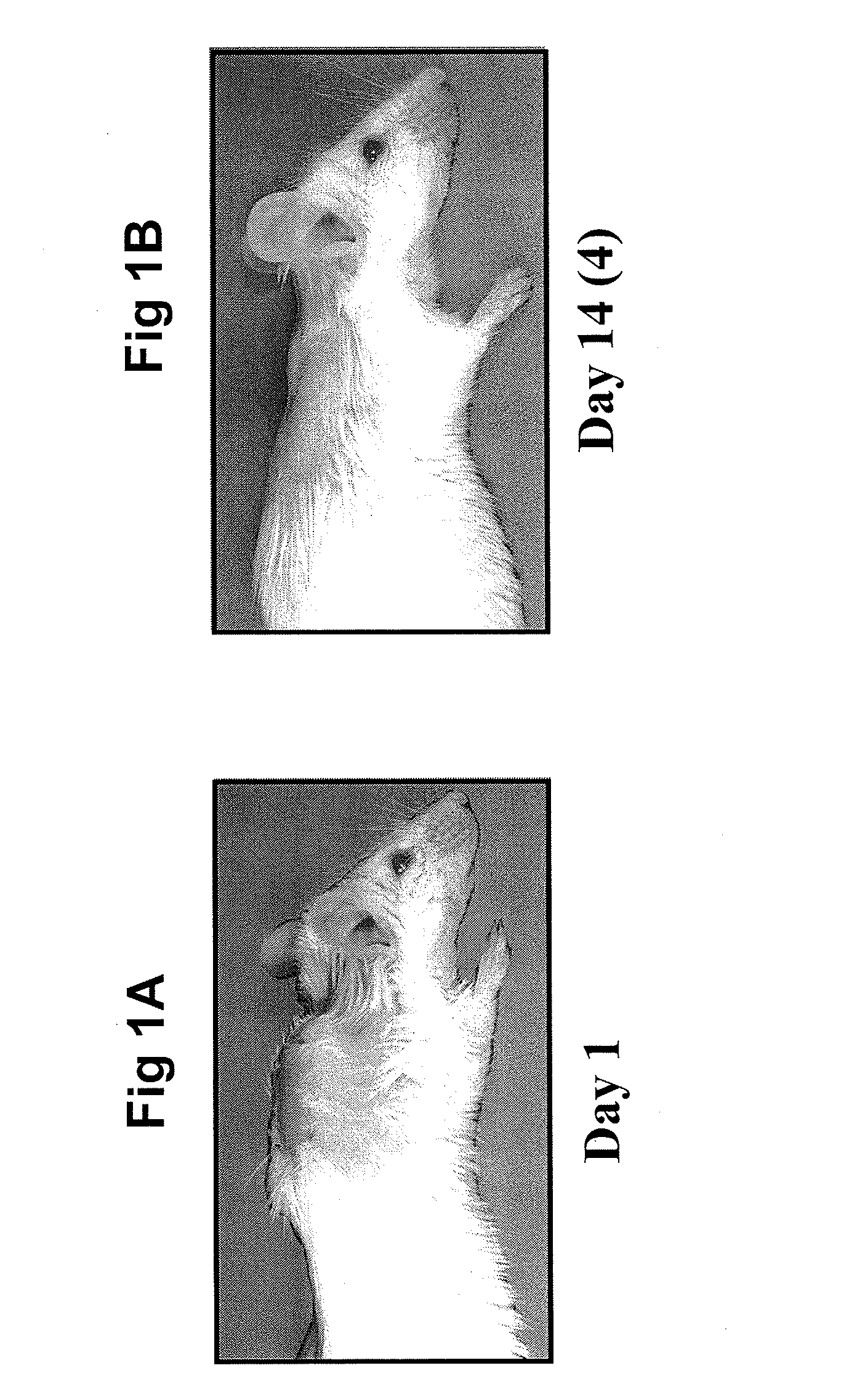 Methods for amyloid removal using Anti-amyloid antibodies