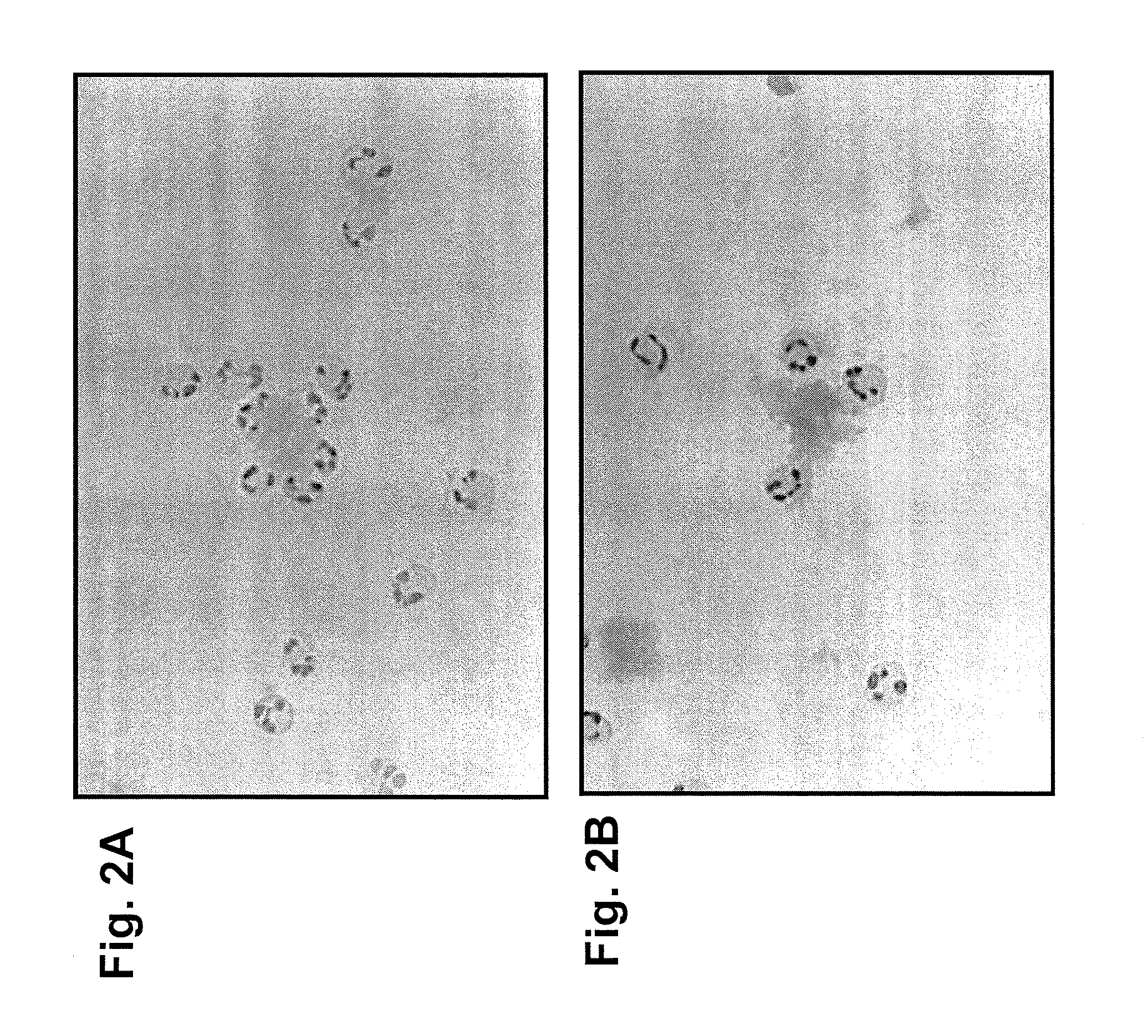 Methods for amyloid removal using Anti-amyloid antibodies