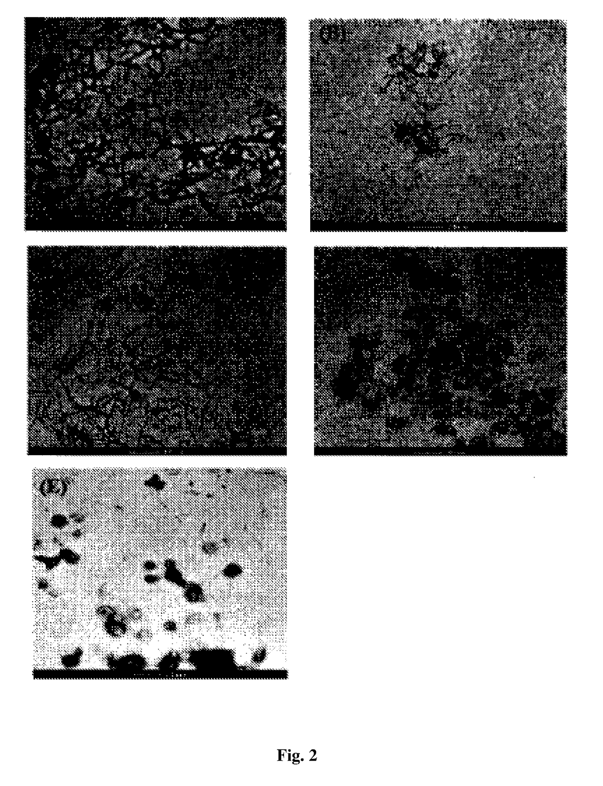 A nanobiocomposite formulation for wound healing and a process for the preparation thereof