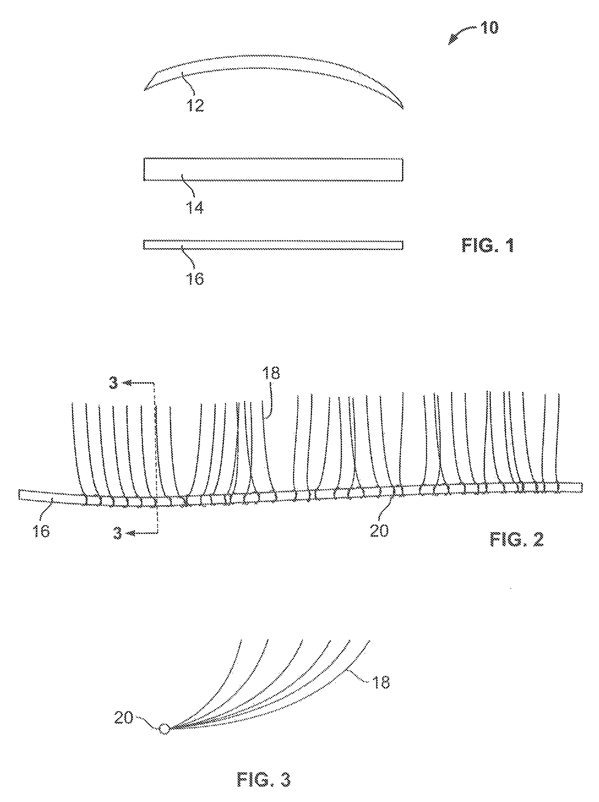 Ciliary implant, ciliary augmentation