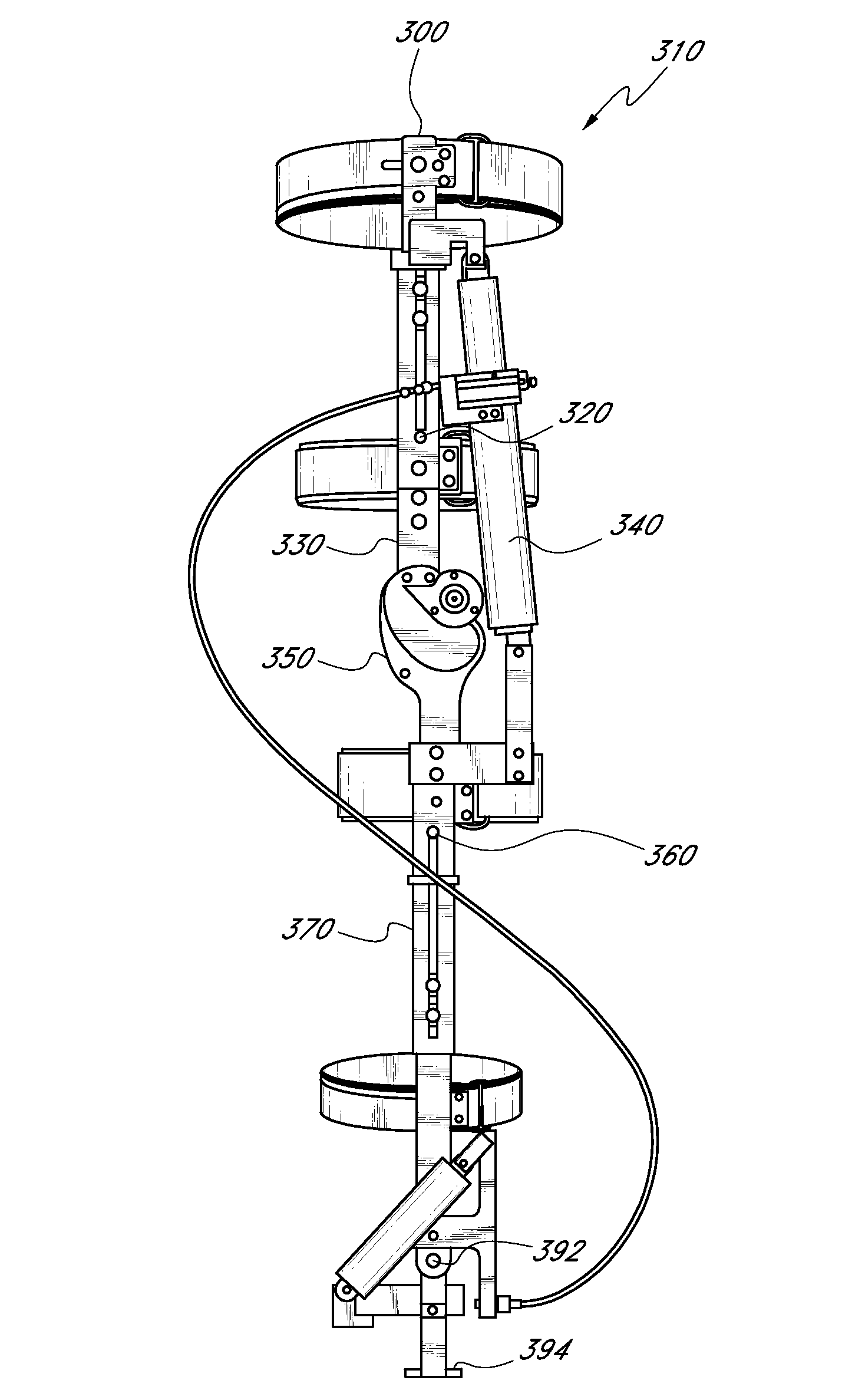 Feedback control systems and methods for prosthetic or orthotic devices