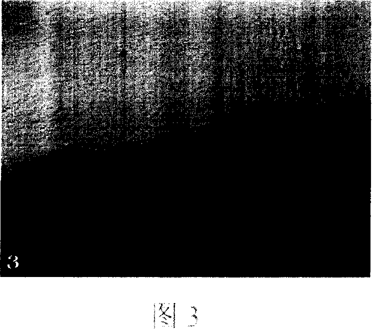 Injection type tissue engineering bone renovation material and construct method thereof
