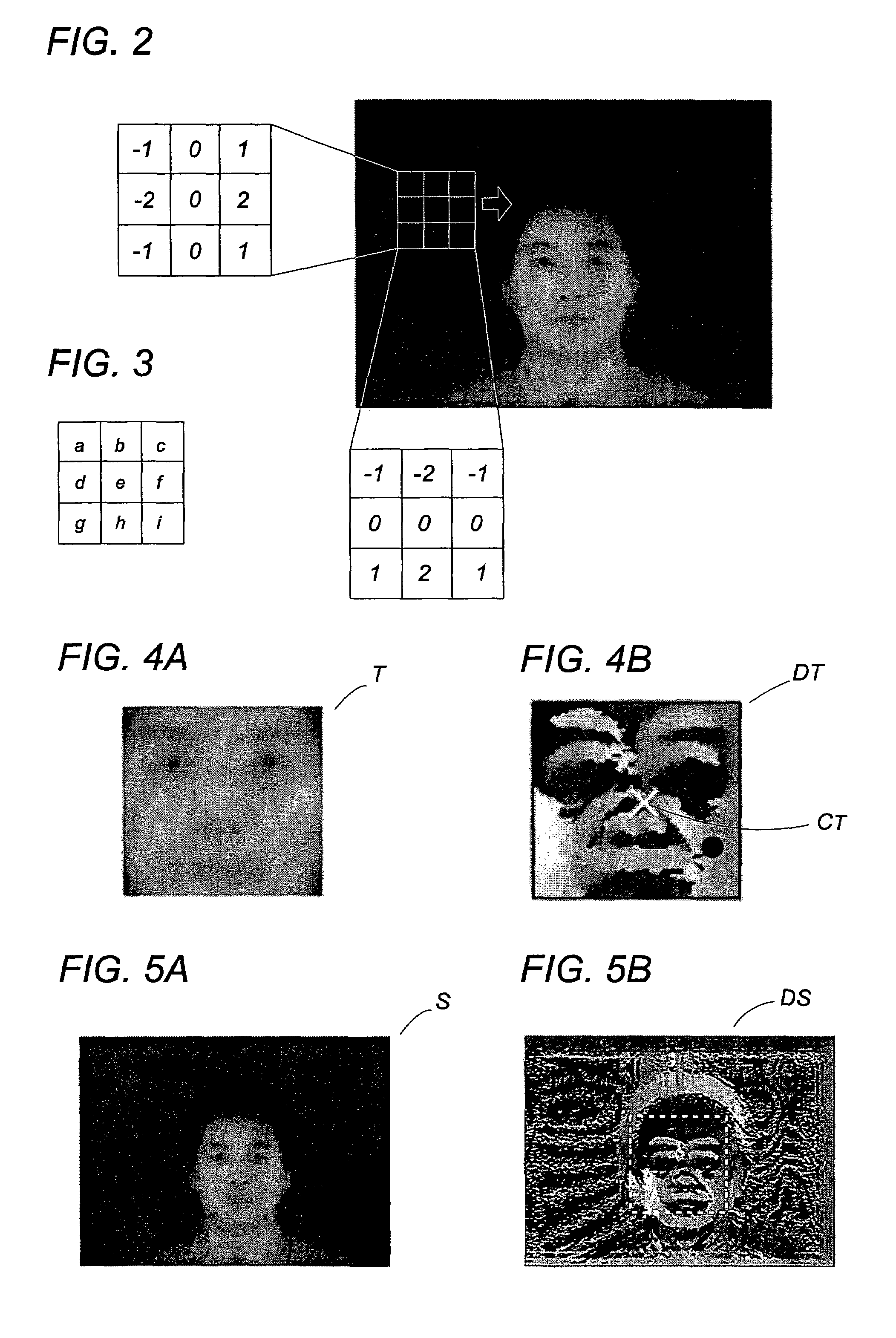 Object recognition system