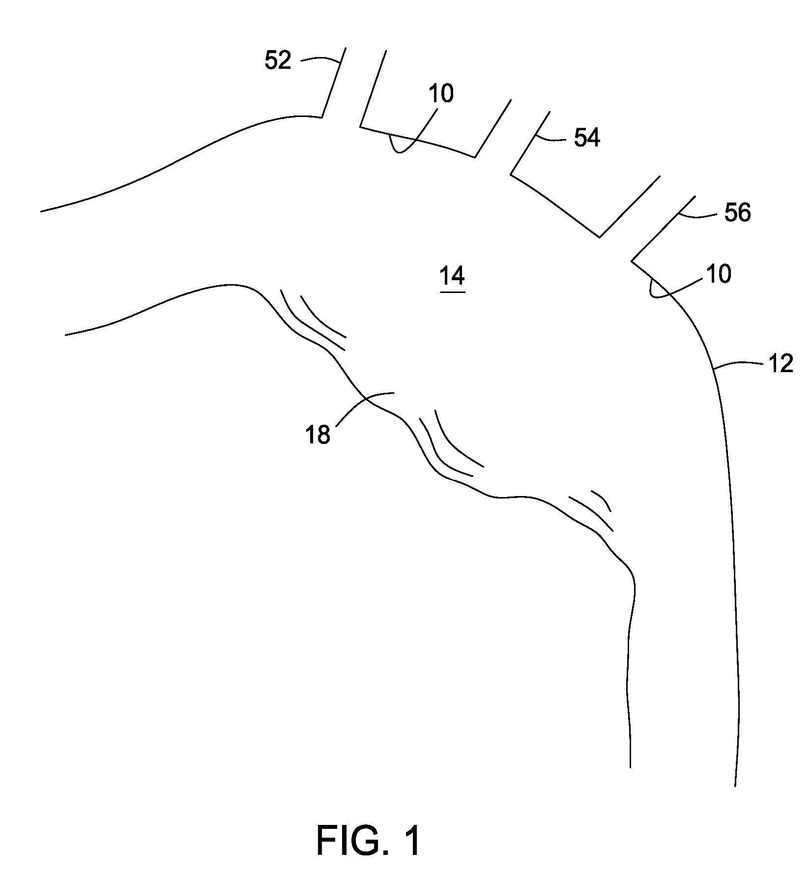 Methods and Apparatus for Treatment of Aneurysms Adjacent to Branch Arteries