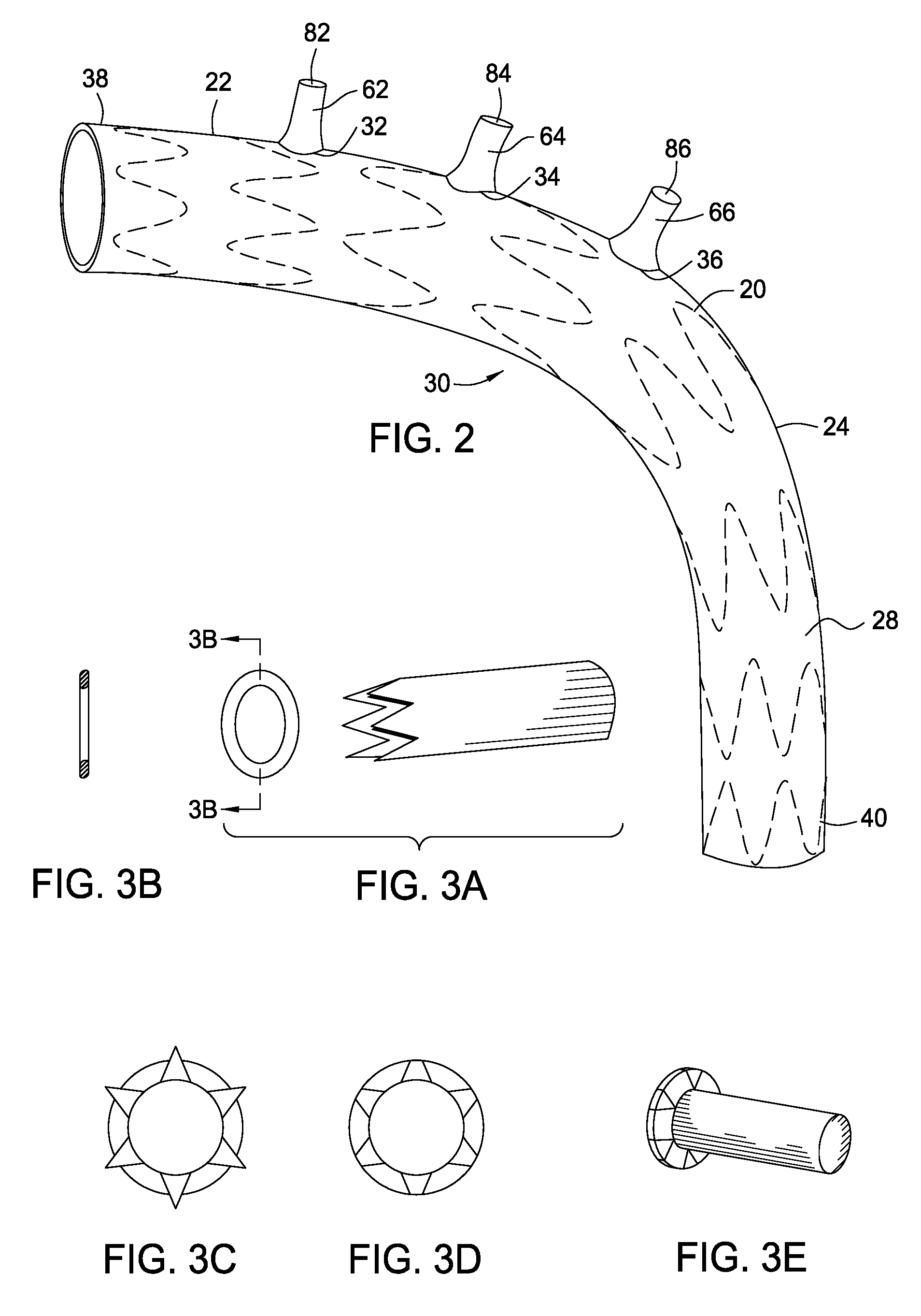 Methods and Apparatus for Treatment of Aneurysms Adjacent to Branch Arteries
