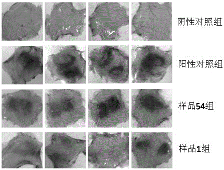 Panax notoginseng saponin composition and preparation method and application thereof