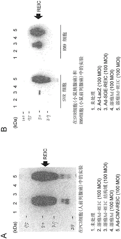 Conditionally replicating adenovirus expressing REIC gene