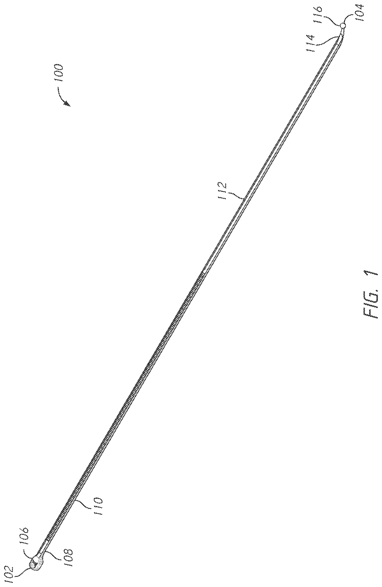 Bone tie methods - Eureka | Patsnap