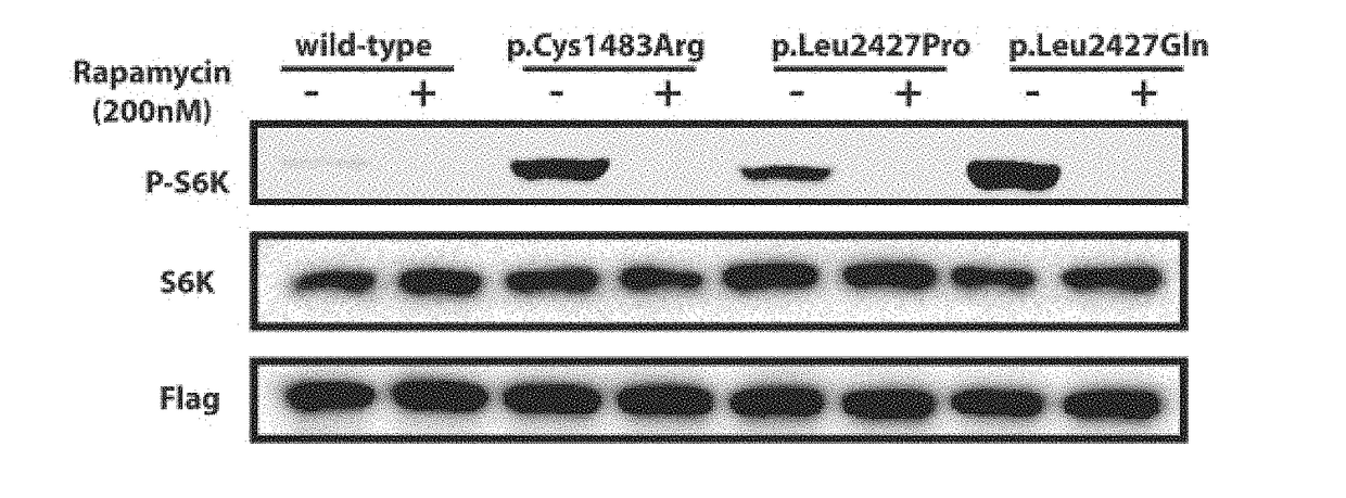 COMPOSITION FOR PREVENTION OR TREATMENT OF INTRACTABLE EPILEPSY COMPRISING mTOR INHIBITOR