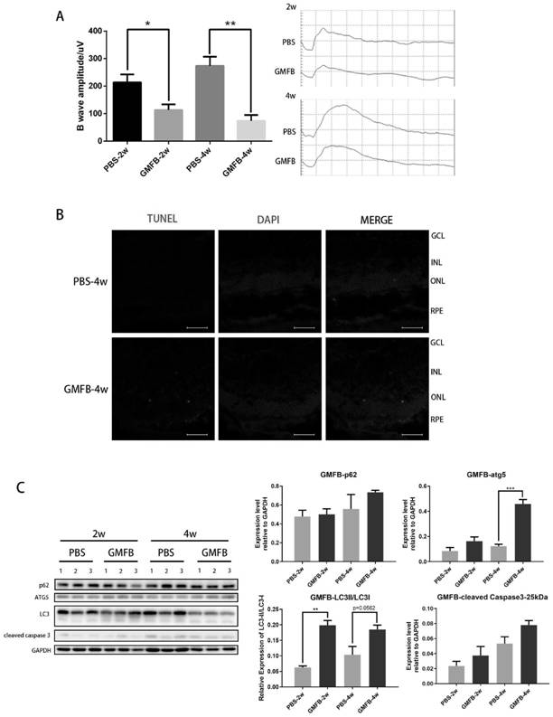 Inhibitor for autophagy and apoptosis of retinal pigment cells RPE and application of inhibitor