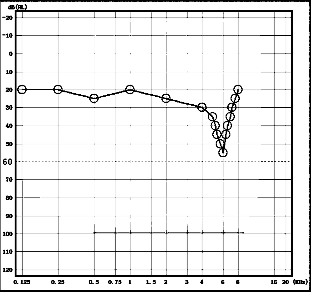 Graph automatic identification method of audiometry results