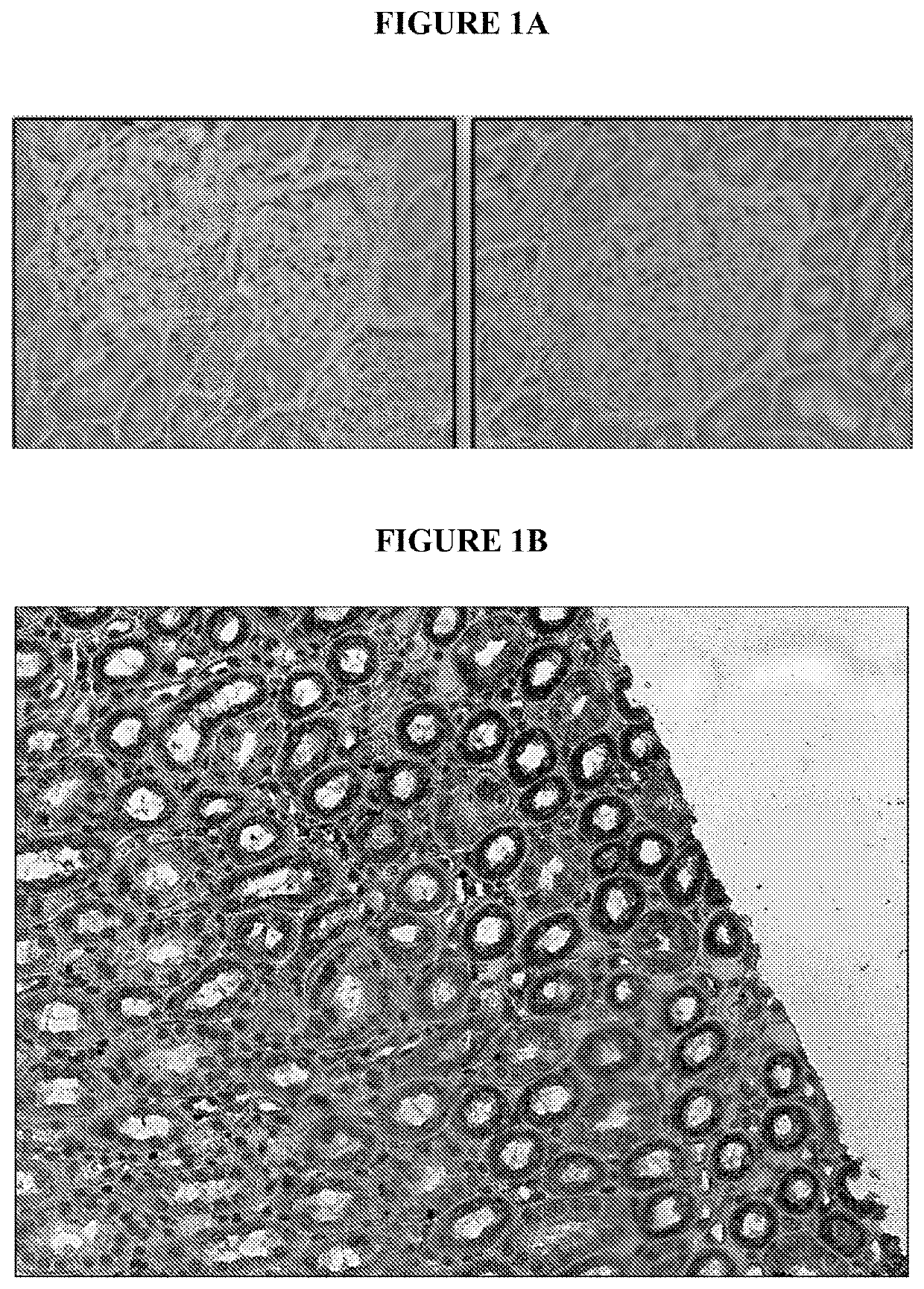 Use of il-12 to generate endogenous erythropoietin