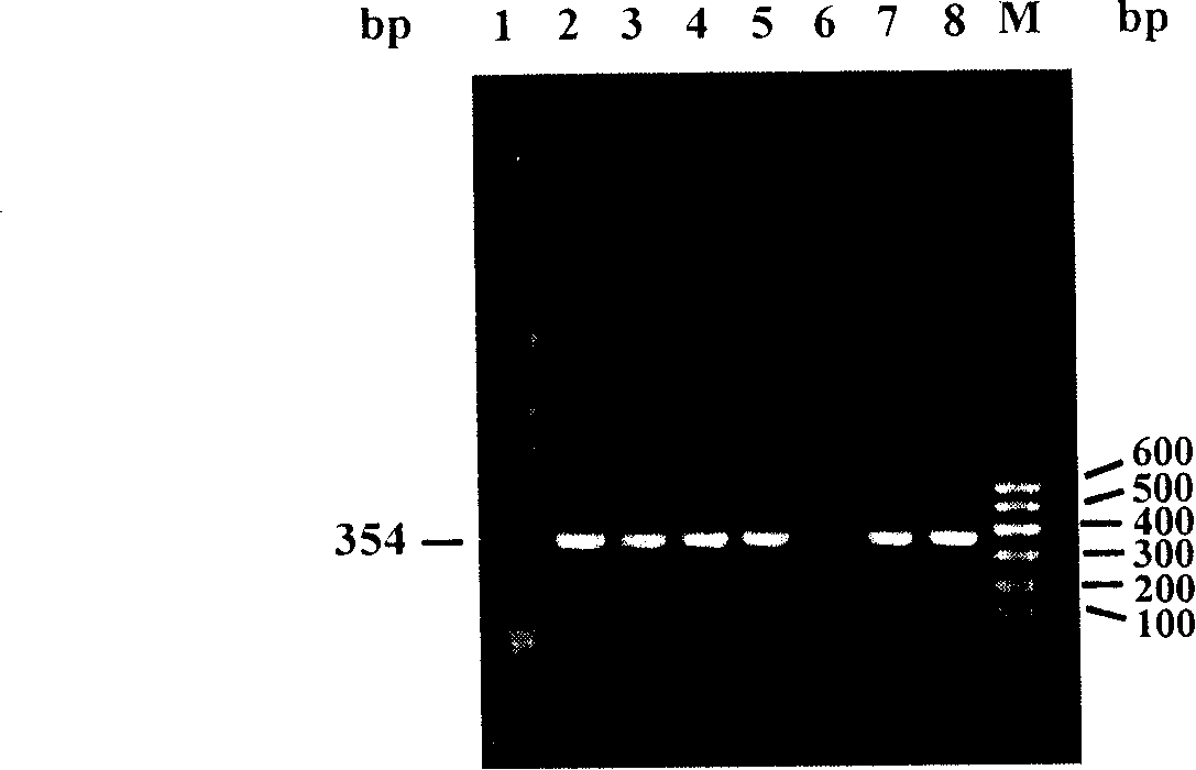 Method for preparing transgenic mouse with central nervous system specific expression Cre recombinase