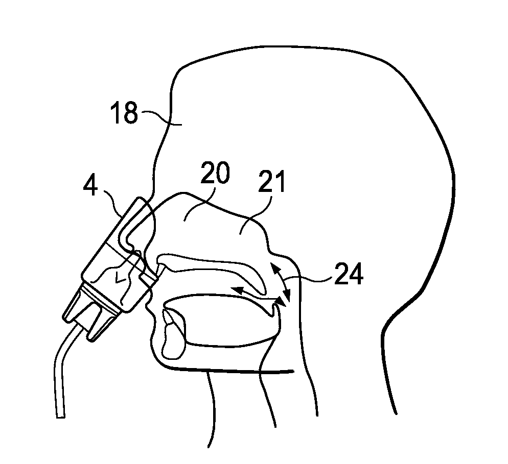 Portable Fluid Delivery System for the Nasal and Paranasal Sinus Cavities