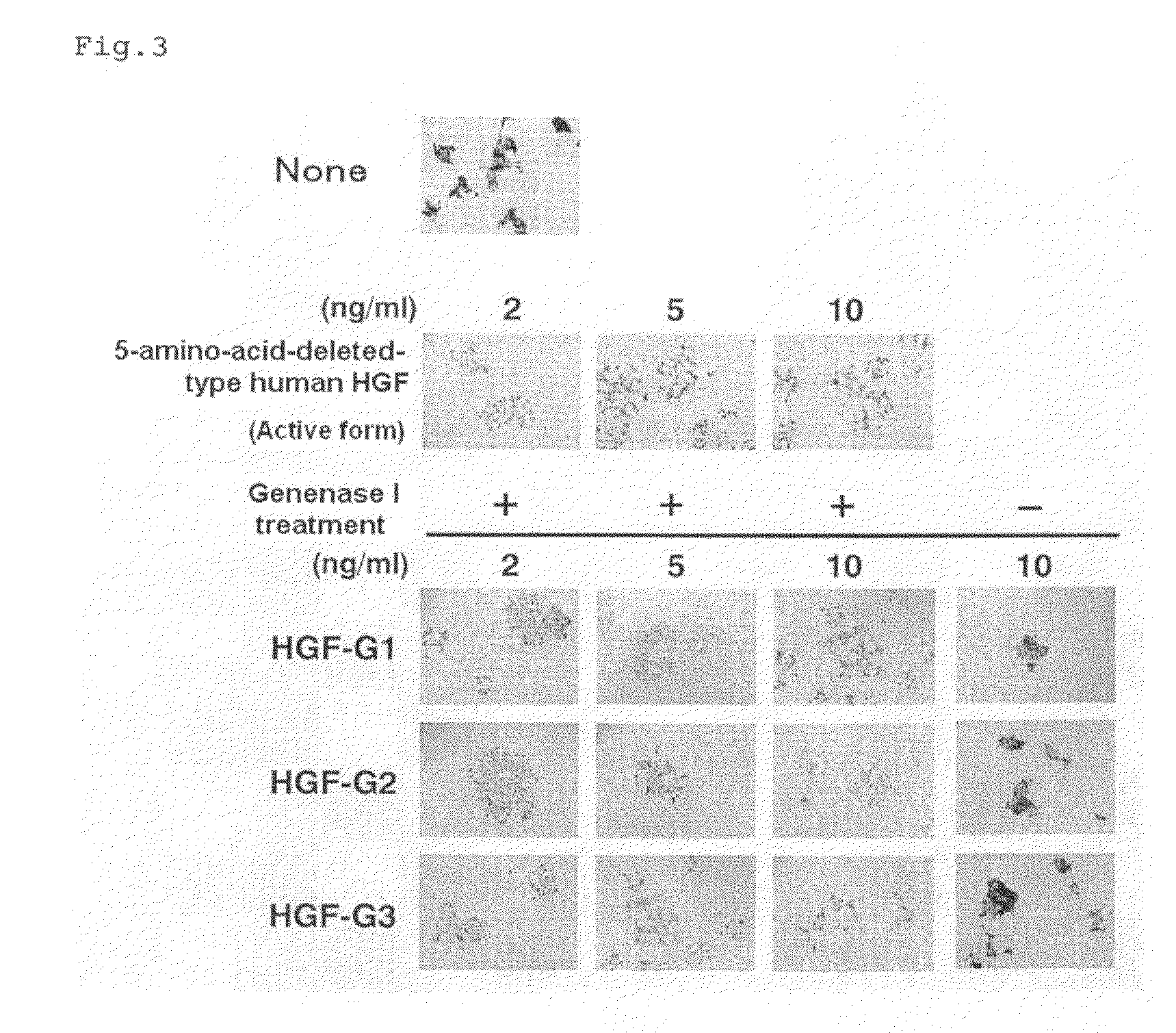 HGF precursor protein variant and active protein thereof