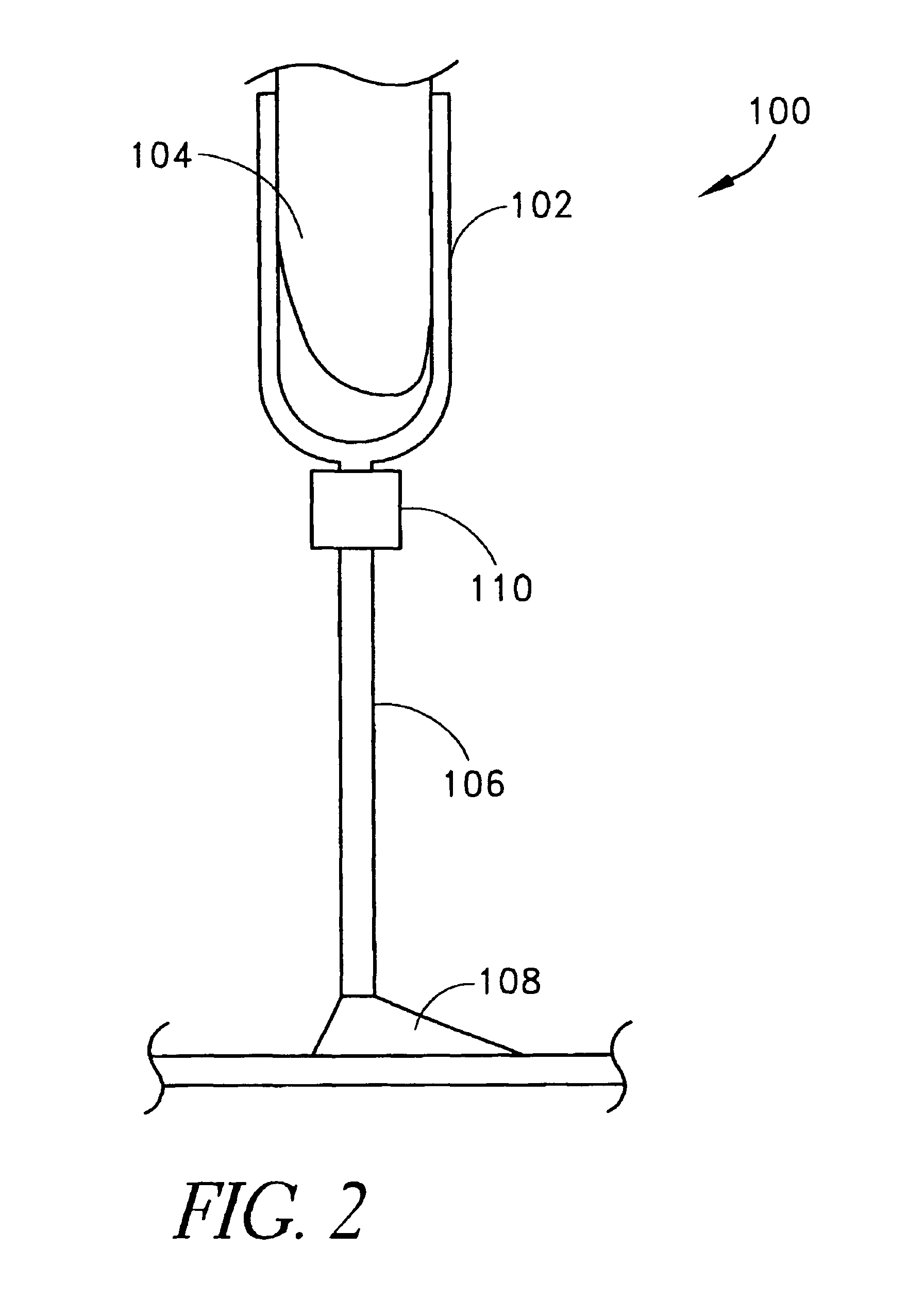 Electronically controlled prosthetic knee