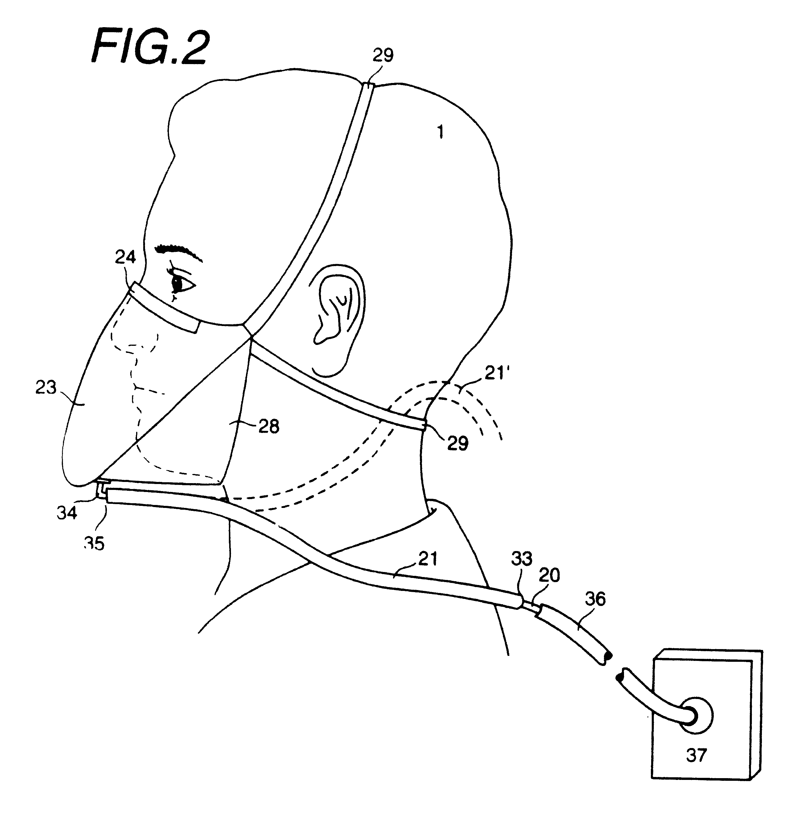 Disposable mask and suction catheter