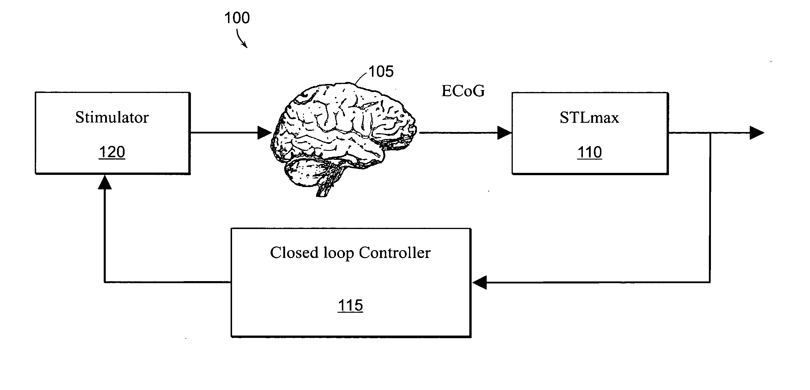 Closed-loop state-dependent seizure prevention systems