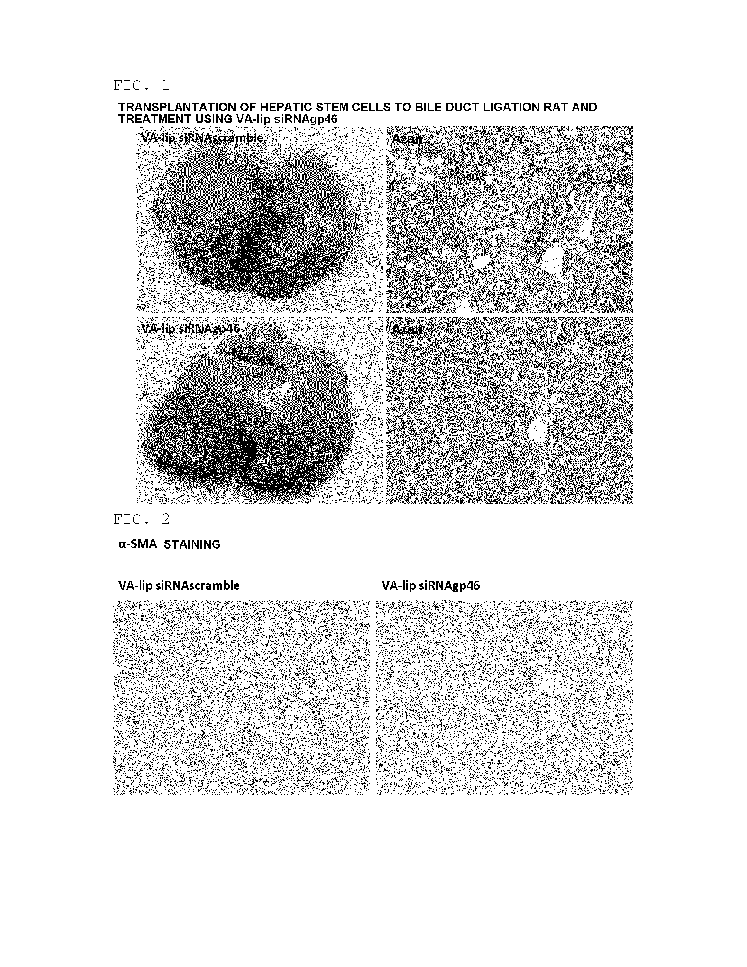 Composition for regenerating normal tissue from fibrotic tissue