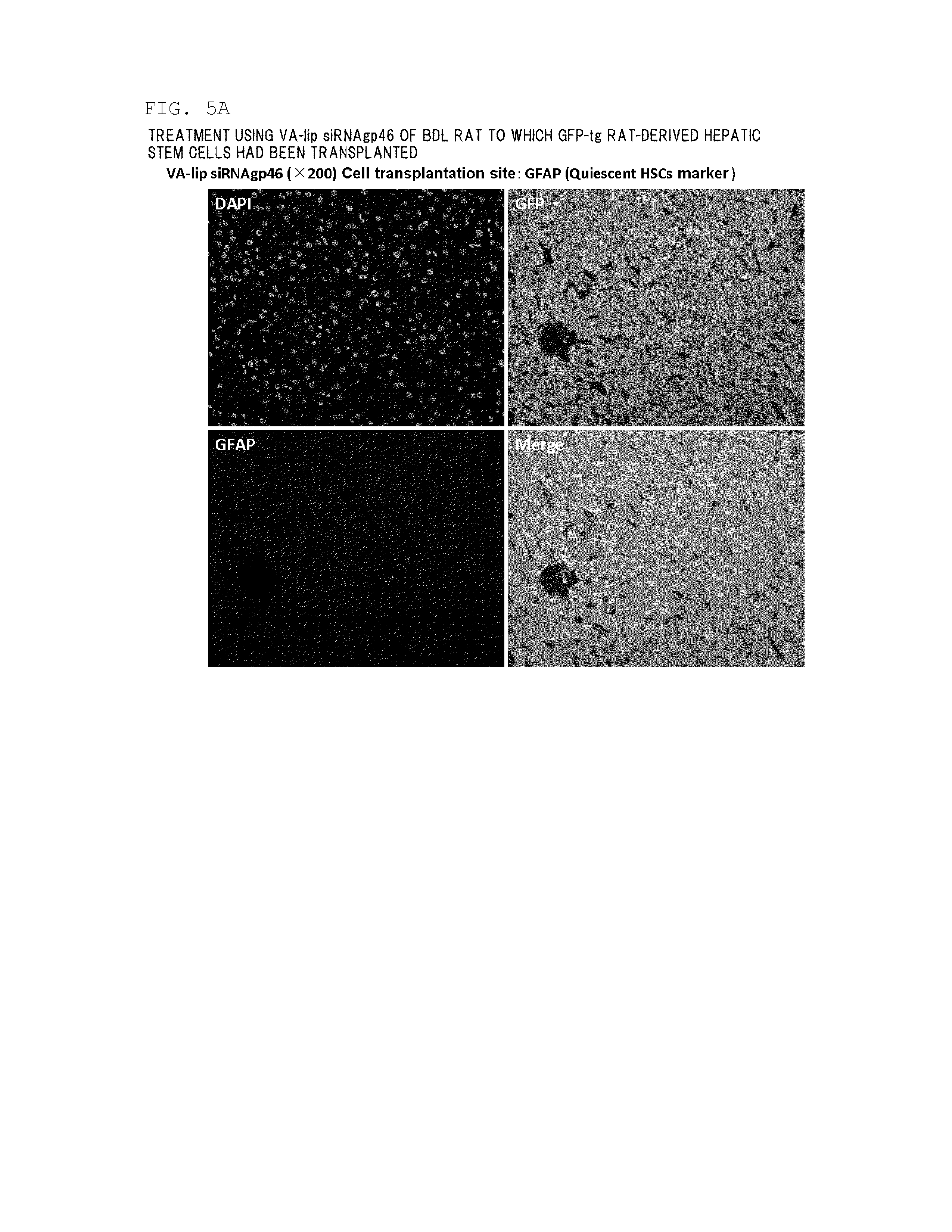 Composition for regenerating normal tissue from fibrotic tissue