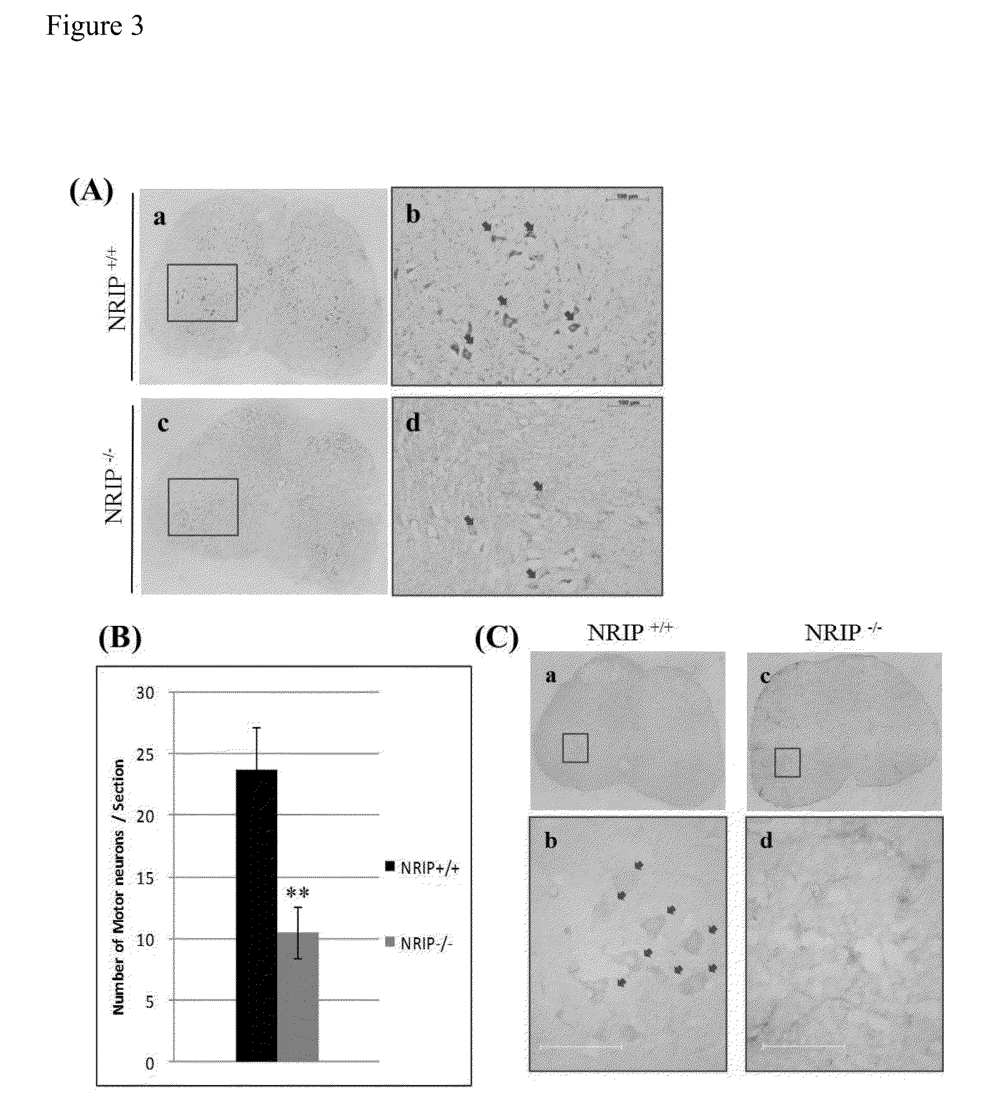 Nrip as a biomarker of abnormal function of motor neurons