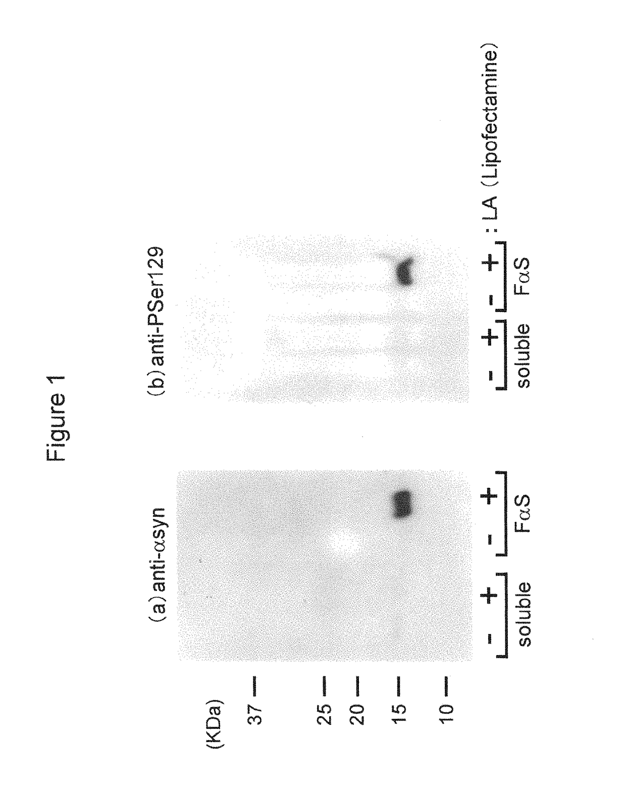 Cell into which protein, which can serve as polymerization nucleus of protein polymer, or polymer thereof is introduced, and method for production of the cell