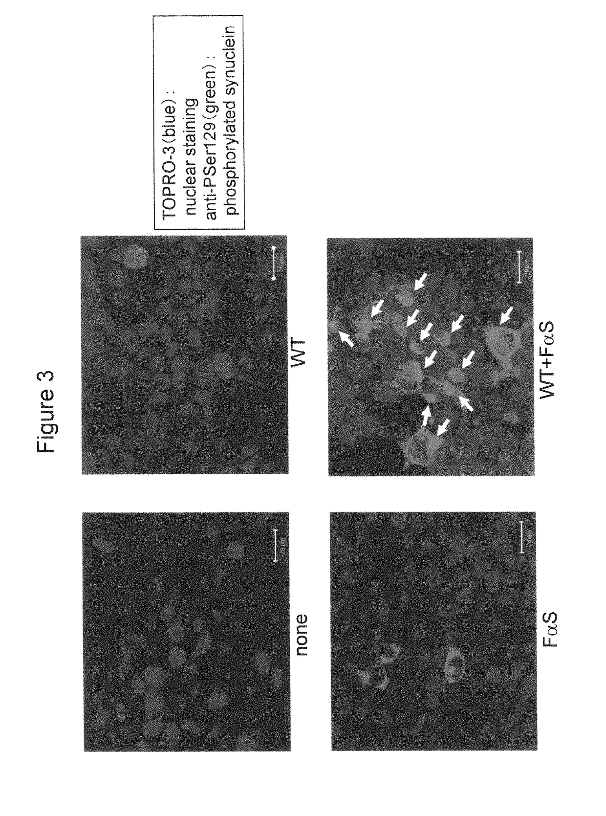 Cell into which protein, which can serve as polymerization nucleus of protein polymer, or polymer thereof is introduced, and method for production of the cell