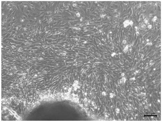 Separation and primary culture method of pigeon craw fibroblasts