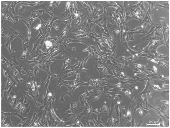 Separation and primary culture method of pigeon craw fibroblasts