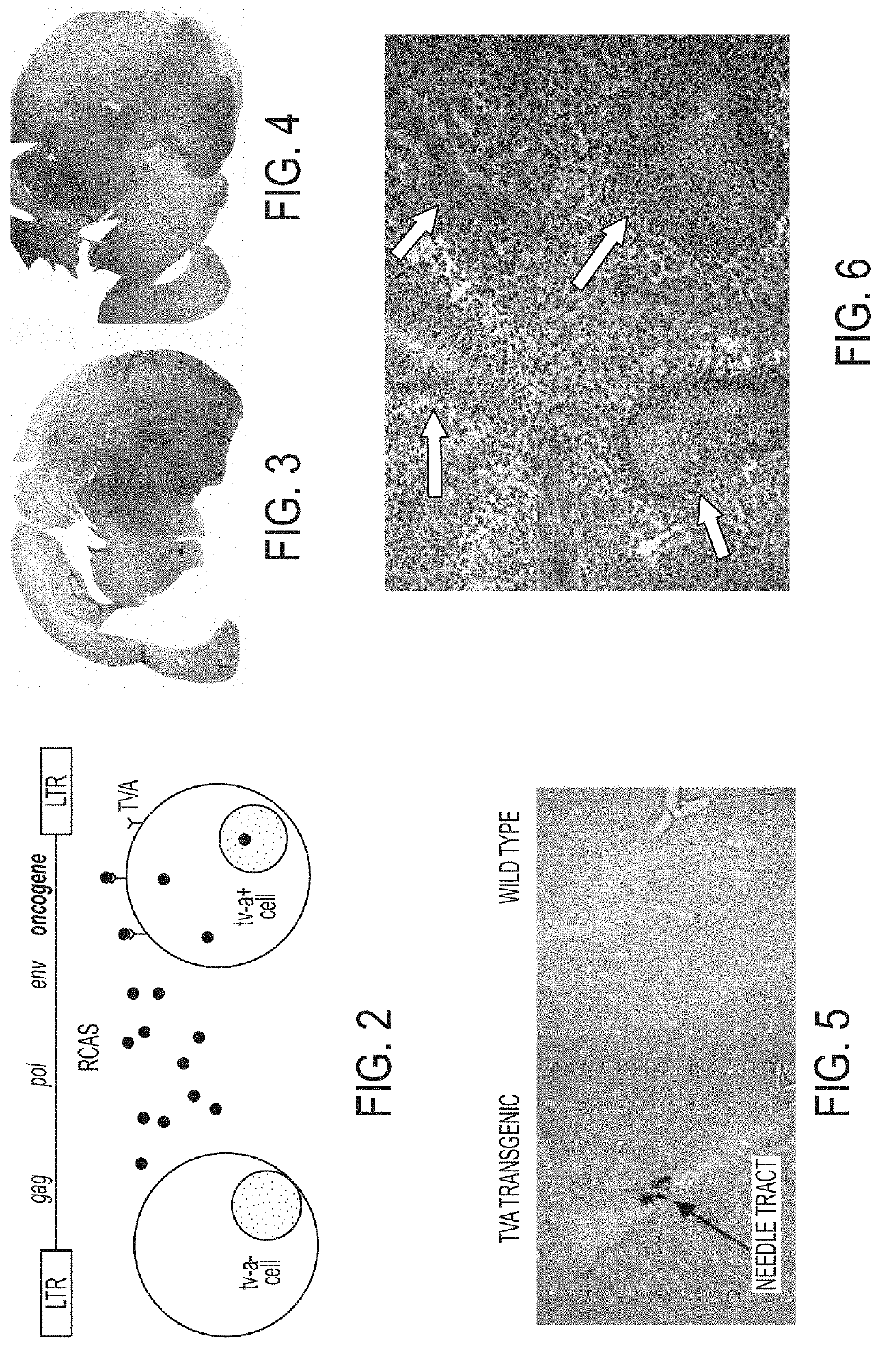 Compositions and methods for targeted particle penetration, distribution, and response in malignant brain tumors