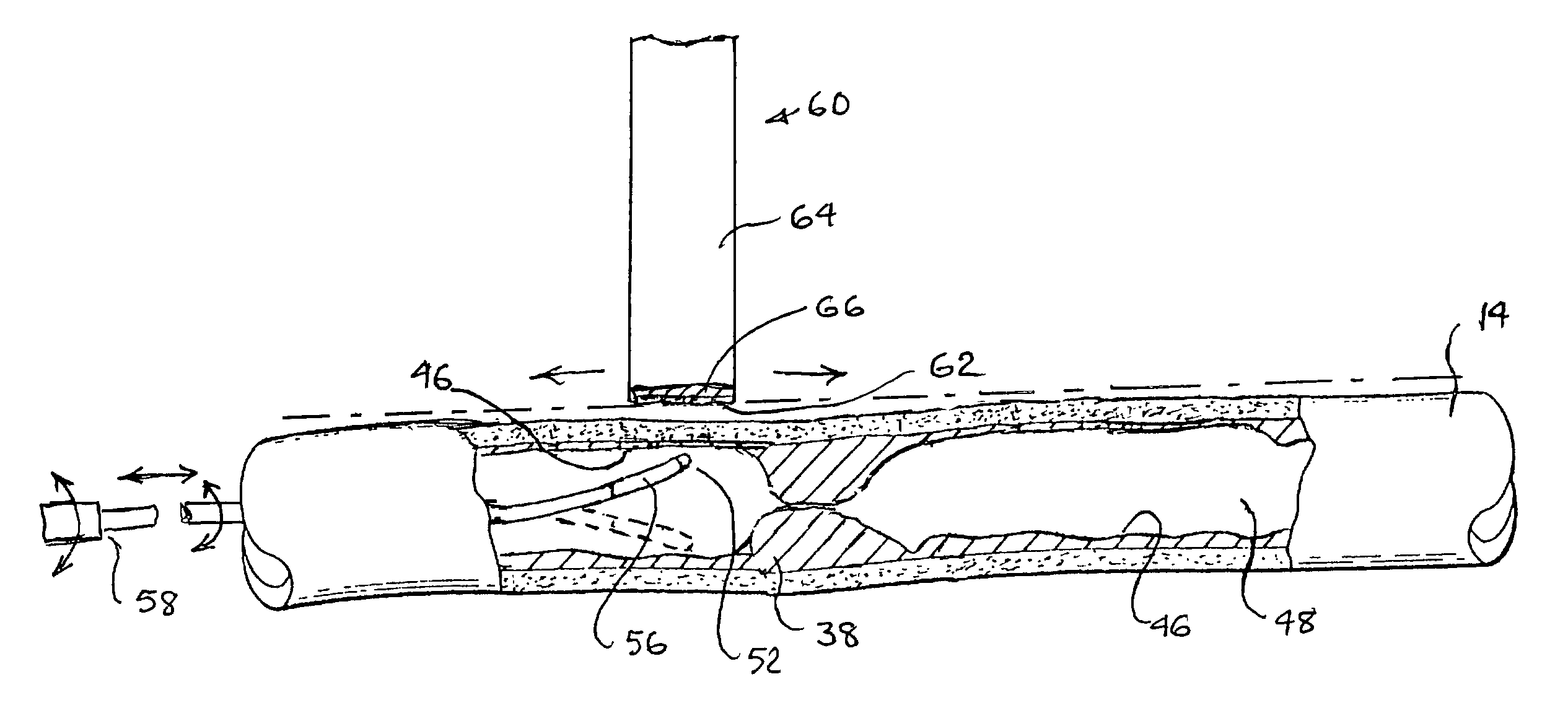 Methods and apparatus for locating body vessels and occlusions in body vessels