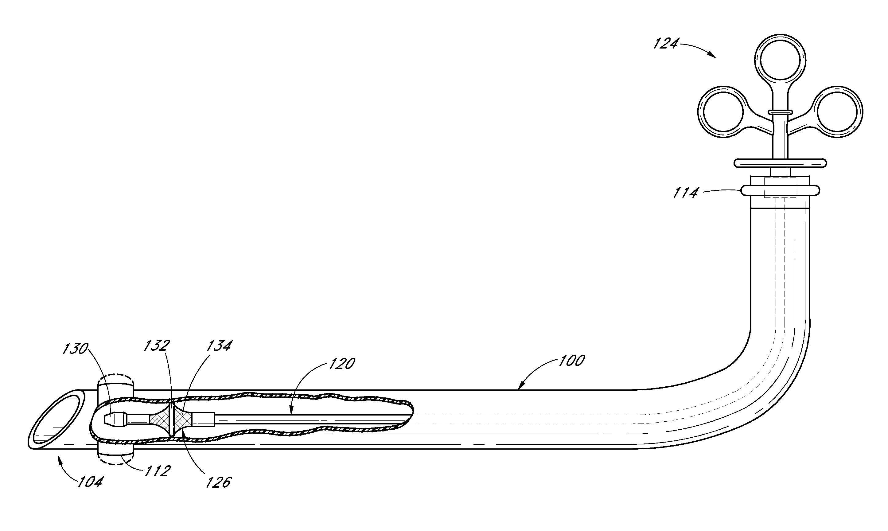 Mechanically-actuated endotracheal tube cleaning device