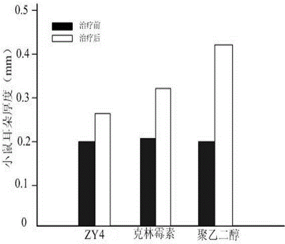Small molecule polypeptide ZY4 and application thereof