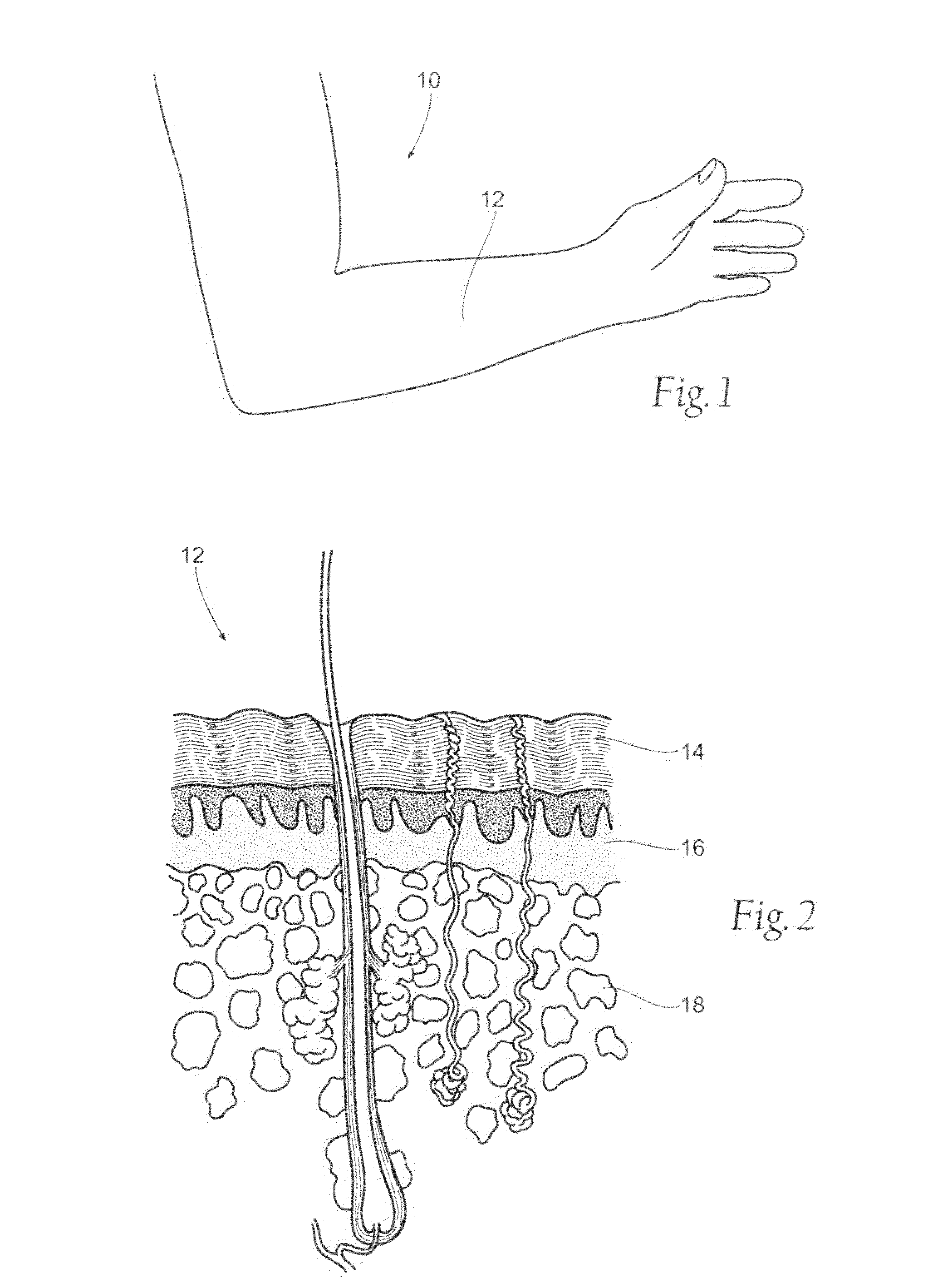 Assemblies, systems, and methods for skin treatment incorporating oxidized cellulose