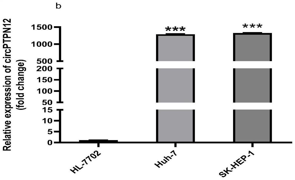 Molecular marker for detection or curative effect evaluation of liver cancer and application