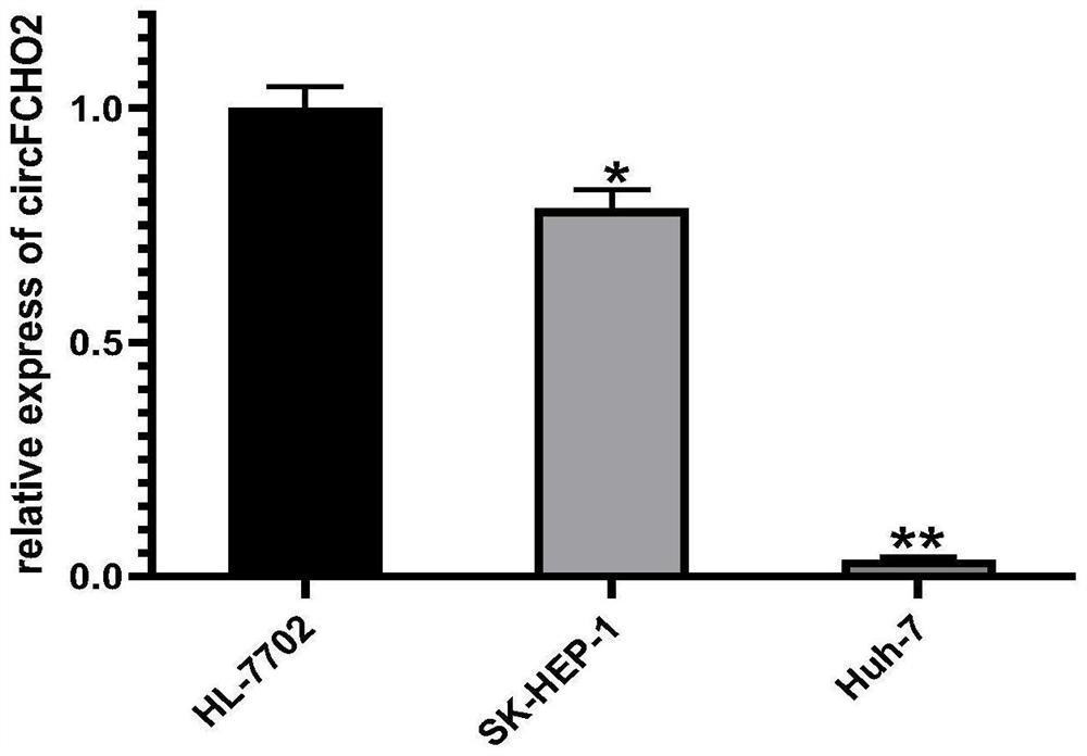 Molecular marker for detection or curative effect evaluation of liver cancer and application